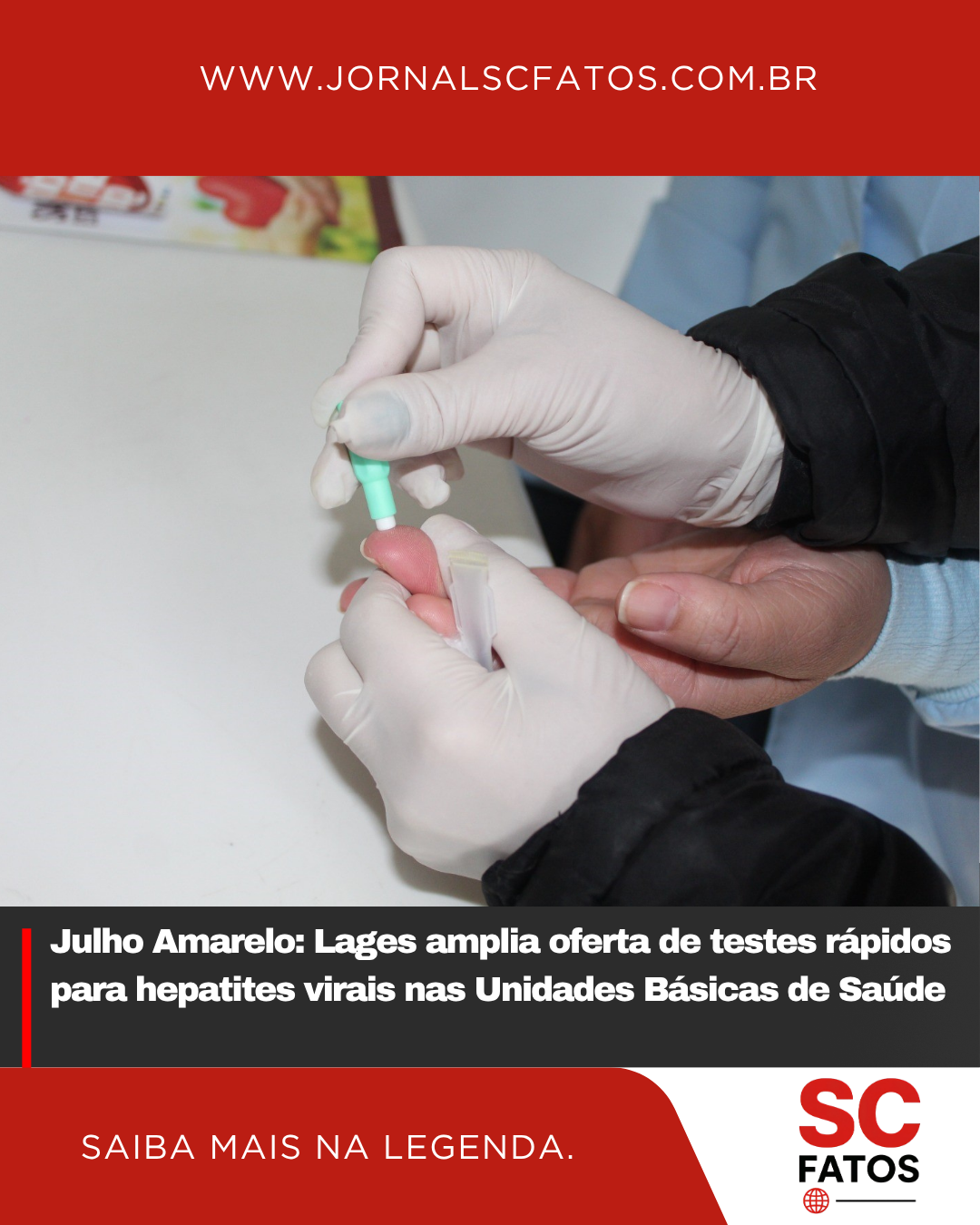 Julho Amarelo: Lages amplia oferta de testes rápidos para hepatites virais nas Unidades Básicas de Saúde