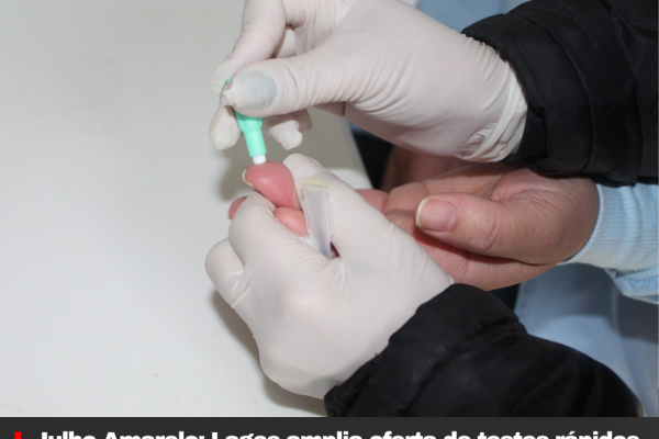 Julho Amarelo: Lages amplia oferta de testes rápidos para hepatites virais nas Unidades Básicas de Saúde