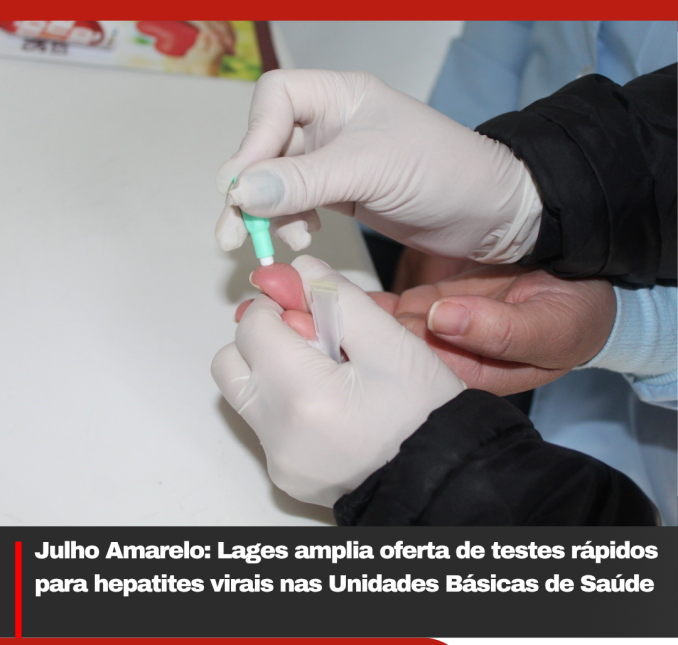 Julho Amarelo: Lages amplia oferta de testes rápidos para hepatites virais nas Unidades Básicas de Saúde